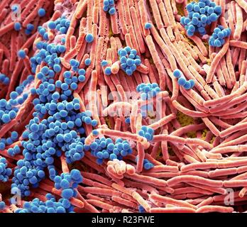 Farbige Scanning Electron Micrograph (SEM) von Bakterien gezüchtet von einem Mobiltelefon. Tests haben gezeigt, dass die durchschnittliche Hörer trägt 18 Mal mehr Po Stockfoto