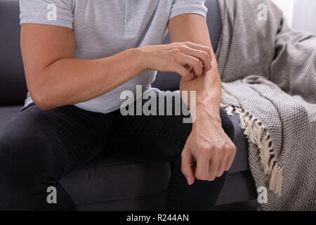 Mittelteil der Mann sitzt auf einem Sofa Juckreiz Leiden. Stockfoto