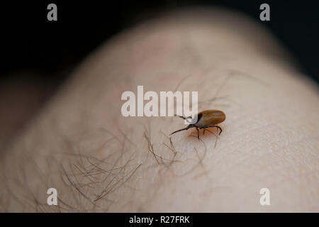 Nach tick auf der menschlichen Haut Stockfoto