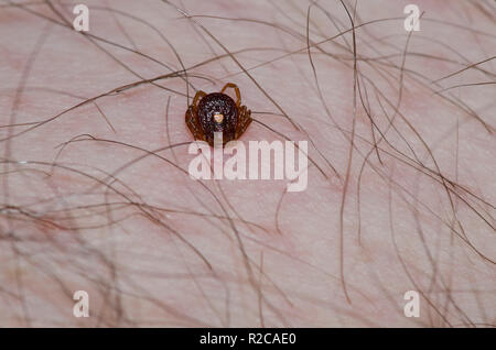 Lone Star Tick, Amblyomma americanum, weiblichen auf die menschliche Haut befestigt Stockfoto