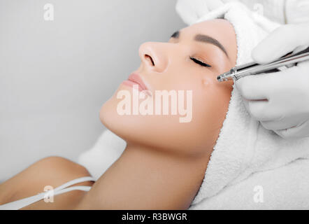 Anti-aging face Peel, Verfahren zur Erneuerung der Haut, Jet Peeling Stockfoto