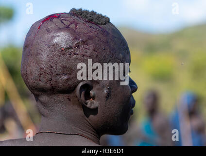 Suri Stamm Krieger während eines donga Stockkampf Ritual verwundet, Omo Valley, Kibish, Äthiopien Stockfoto