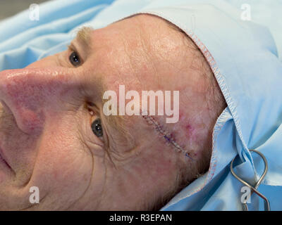 Mann BCC-op in der Nähe bis mittleren Alters Stockfoto