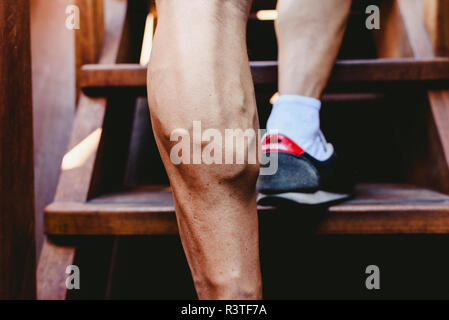 Große sichtbare Venen der Wadenmuskulatur im Bein des Mannes. Stockfoto