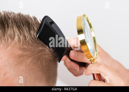 Arzt des Patienten Haare durch Lupe suchen Stockfoto