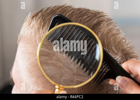 Arzt des Patienten Haare durch Lupe suchen Stockfoto