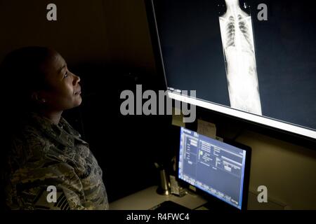 Master Sgt. Tracey McLendon, 23 d Medical Support Squadron Flug chief für diagnostische Bildgebung, liest eine X-ray, Oktober 24, 2016, bei Moody Air Force Base, Ga eine einfache gebrochenen Knochen könnte potenziell tödlich, wenn knochenfragmente Schäden Organe. Wenn die Radiologie Abschnitt Bewertungen ihren X-Strahlen, die auf der Suche nach Unregelmäßigkeiten. Stockfoto