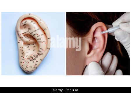 Aurikulotherapie Konzept. Stockfoto