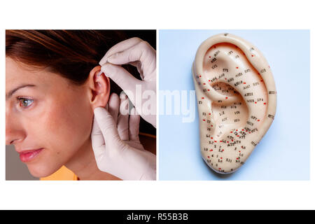 Aurikulotherapie Konzept. Stockfoto