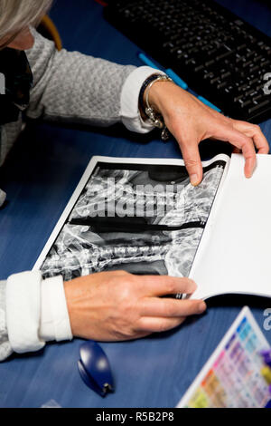 Arzt für Allgemeinmedizin Untersuchung eine Röntgenaufnahme der Halswirbelsäule. Stockfoto