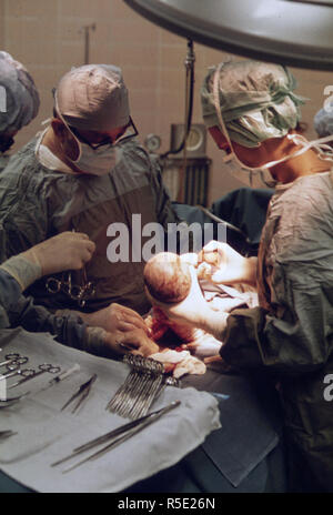 Ärzte führen einen Kaiserschnitt einer New-Born Kind in Union Hospital in New Ulm, Minnesota... Ca. 1975 Stockfoto