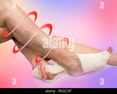 Die ältere Frau, die Korrektur einer elastischen Bandage, die ihr Bein gebunden. Stockfoto