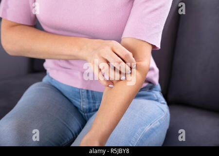 Nahaufnahme von einer Frau Hand Kratzen die Krätze auf Ihrem Arm Stockfoto