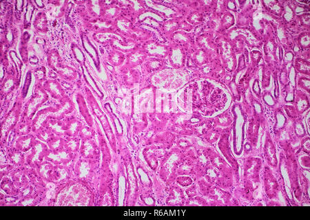 Menschliche Niere, kortikale Zone unter Mikroskop Stockfoto