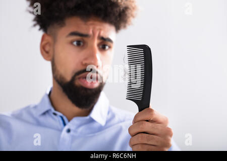 Mann bei Haarausfall Suchen Stockfoto