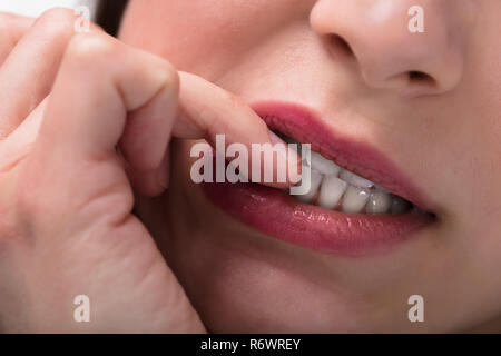 Geschäftsfrau beißen ihr Fingernagel Stockfoto