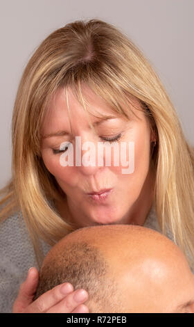 Frau küssen ist ein Mann balding Kopf Stockfoto