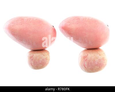 3D-Darstellung eines gesunden und eine vergrößerte Prostata. Stockfoto