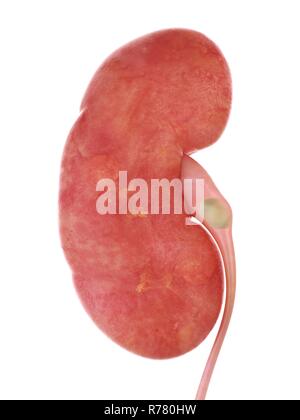 3D-gerenderte Abbildung: ein nierenstein. Stockfoto