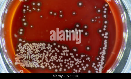 Petrischale mit Bakterien, bakterielle Kolonie Kommissionierung für DNA Klonen Stockfoto
