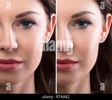 Portrait einer jungen Frau Gesicht vor und nach der kosmetischen Verfahren Stockfoto