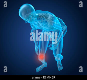 Knieschmerzen Angriff, der Mensch Leiden der Wirbelsäule Knie. 3D-Darstellung Stockfoto