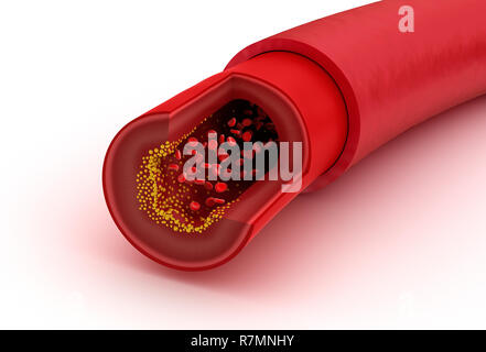Blutgefäß, in Scheiben geschnitten Makro mit Erythrozyten, medizinisch genaue 3D-Illustration Stockfoto