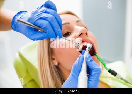 Junge Frau beim Zahnarzt. Zahnarzt ist polieren ihre Zähne. Stockfoto