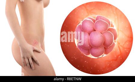 Abbildung: eine schwangere Frau mit sichtbaren Gebärmutter und 16 Zelle Stadium Embryo. Stockfoto
