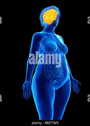 Abbildung des Gehirns eine übergewichtige Frau. Stockfoto