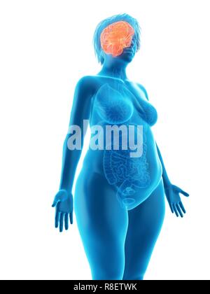Abbildung des Gehirns eine übergewichtige Frau. Stockfoto