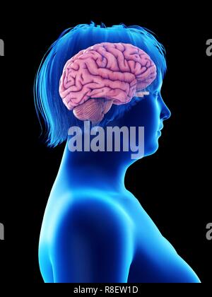 Abbildung des Gehirns eine übergewichtige Frau. Stockfoto