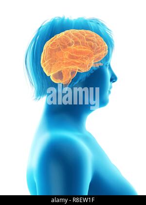 Abbildung des Gehirns eine übergewichtige Frau. Stockfoto