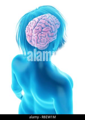 Abbildung des Gehirns eine übergewichtige Frau. Stockfoto