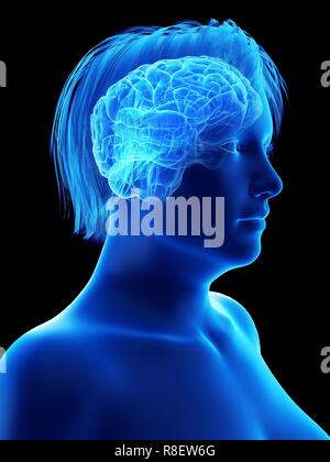 Abbildung des Gehirns eine übergewichtige Frau. Stockfoto