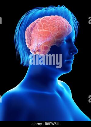Abbildung des Gehirns eine übergewichtige Frau. Stockfoto