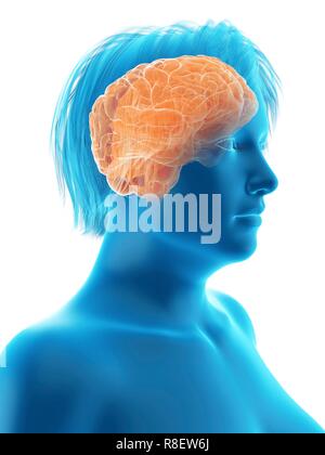 Abbildung des Gehirns eine übergewichtige Frau. Stockfoto