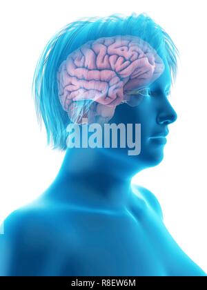 Abbildung des Gehirns eine übergewichtige Frau. Stockfoto