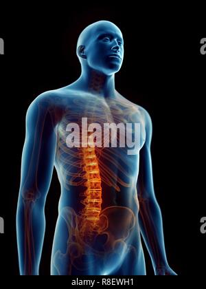 Abbildung: schmerzhafte Wirbelsäule eines Menschen. Stockfoto