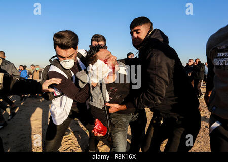 Gaza, Palästina. 14. Dezember 2018 einen verletzten Mann, während der israelischen Streitkräfte in palästinensische Demonstranten einmischen, so wie Sie es einem Protest in th Stufe Stockfoto