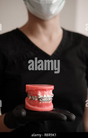 Zahnarzt in schwarzen Handschuhe holding Zahnmedizinische casting Modell menschlichen Backen mit Klammern in der prothetischen Labor. Zahnheilkunde, Kieferorthopädie. Schließen oben. Selektive foc Stockfoto
