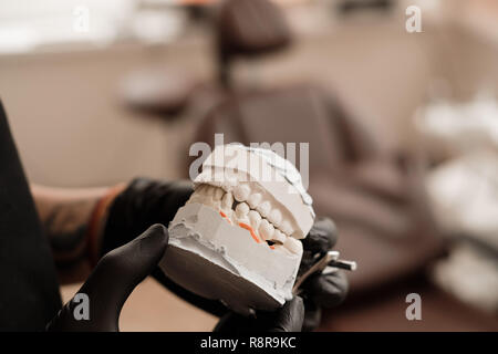 Gipsabguss der Backen. Zahnarzt in schwarzen Handschuhe holding Zahnmedizinische gießen Gips Modell menschlichen Kiefer in der prothetischen Labor. Zahnheilkunde, Kieferorthopädie. Schließen Stockfoto