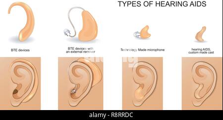 Vector Illustration der Arten von Hörgeräten Stock Vektor