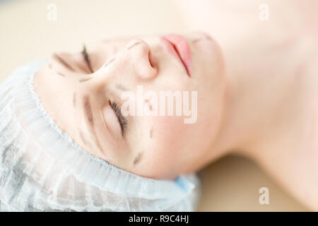 Vor plastische Chirurgie Stockfoto