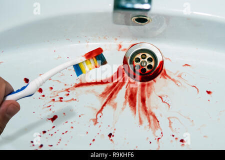Nahaufnahme von Zahnbürste in männlicher Hand mit Spuren von Blut auf einem Blut - Spitted Waschbecken Hintergrund. Blutige Zahn Bürste in der Nähe der Flecken Waschbecken. Entlüftung g Stockfoto