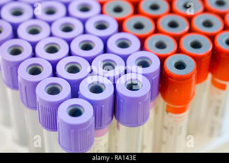 Gruppe medizinische Probenröhrchen, Röhrchen Blut für im Labor Krankheit des Patienten zu diagnostizieren. Stockfoto