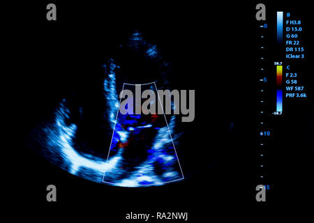 Bunte Bild der modernen Ultraschall überwachen. Ultrasonographie Maschine. High-tech-Medizin und medizinische Geräte. Die Ultraschalldiagnostik in mir verwendet Stockfoto