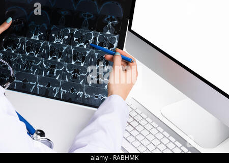 Arzt suchen Bei Computertomographie x-ray Image, der Medizin Arzt Arbeitstisch mit Computer. Healthcare Konzept Stockfoto