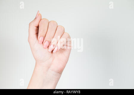 Nahaufnahme des 1 Weibliche weiße Hand mit alten Gel poliert Maniküre benötigen Korrektur nach mehreren Wochen tragen. Horizontale Farbfotografie. Stockfoto