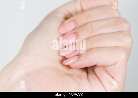 Nahaufnahme des 1 Weibliche weiße Hand mit alten Gel poliert Maniküre benötigen Korrektur nach mehreren Wochen tragen. Horizontale Farbfotografie. Stockfoto